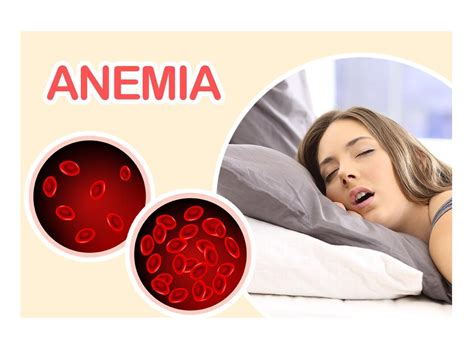 que es la anemia